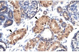 Human kidney; ZFPL1 antibody - middle region in Human kidney cells using Immunohistochemistry (ZFPL1 抗体  (Middle Region))