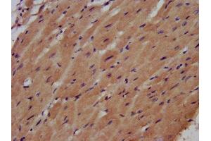 IHC image of ABIN7161246 diluted at 1:500 and staining in paraffin-embedded human heart tissue performed on a Leica BondTM system. (AHNAK 抗体  (AA 5689-5801))