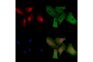 ABIN6260150 and ABIN6279147 staining  cells by IF/ICC. (ATXN7 抗体  (Internal Region))