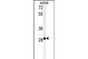 Western blot analysis in A2058 cell line lysates (35ug/lane). (C11orf46 抗体  (C-Term))