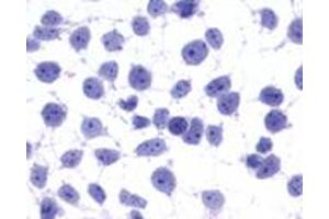 Anti-GPR45 antibody immunocytochemistry (ICC) staining of untransfected HEK293 human embryonic kidney cells. (GPR45 抗体  (Cytoplasmic Domain))
