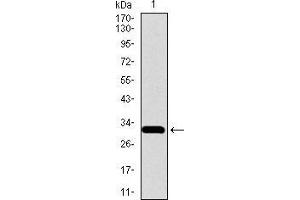 Western blot analysis using SLC27A5 mAb against human SLC27A5 recombinant protein. (SLC27A5 抗体  (AA 508-570))