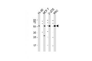 All lanes : Anti-EI2BG Antibody at 1:2000 dilution Lane 1: HL-60 whole cell lysate Lane 2: MCF-7 whole cell lysate Lane 3: U-2OS whole cell lysate Lane 4: K562 whole cell lysate Lysates/proteins at 20 μg per lane. (EIF2B3 抗体  (AA 110-452))