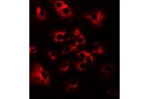 Immunofluorescent analysis of HAI-2 staining in Hela cells. (SPINT2 抗体)