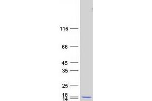 Western Blotting (WB) image for NOTCH-Regulated Ankyrin Repeat Protein (NRARP) protein (Myc-DYKDDDDK Tag) (ABIN2727477)