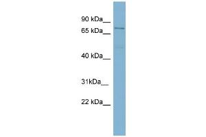 WB Suggested Anti-TGM4  Antibody Titration: 0. (TGM4 抗体  (N-Term))