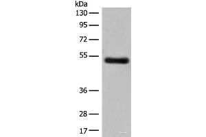 Western blot analysis of Human breast cancer tissue lysate using GK5 Polyclonal Antibody at dilution of 1:500 (GK5 抗体)