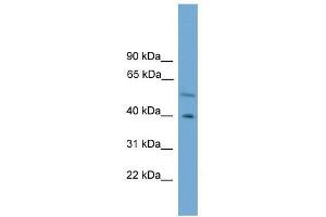 Western Blot showing CLUAP1 antibody used at a concentration of 1-2 ug/ml to detect its target protein. (CLUAP1 抗体  (C-Term))