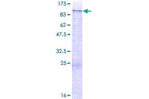 ZNF254 Protein (AA 1-659) (GST tag)