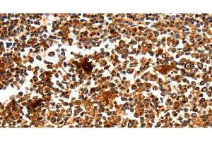 Immunohistochemistry of paraffin-embedded Human tonsil using MYOZ1 Polyclonal Antibody at dilution of 1:50 (Myozenin 1 抗体)