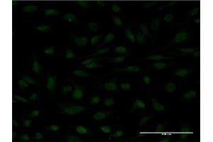 Immunofluorescence of monoclonal antibody to MYCBP on HeLa cell. (MYCBP 抗体  (AA 34-103))