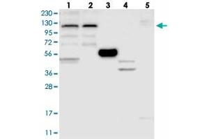 Western blot analysis of Lane 1: RT-4, Lane 2: U-251 MG, Lane 3: Human Plasma, Lane 4: Liver, Lane 5: Tonsil with ZSWIM5 polyclonal antibody . (ZSWIM5 抗体)