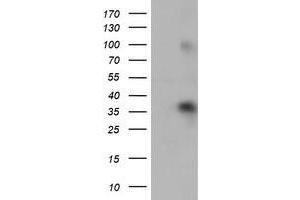 Western Blotting (WB) image for anti-Zinc Finger Protein 36, C3H Type, Homolog (Mouse) (ZFP36) antibody (ABIN1501406) (ZFP36 抗体)
