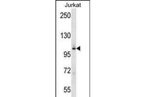 P4K2 Antibody (Center) (ABIN656275 and ABIN2845587) western blot analysis in Jurkat cell line lysates (35 μg/lane). (MAP4K2 抗体  (AA 321-349))