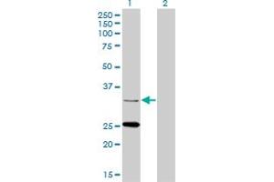 Western Blot analysis of STAR expression in transfected 293T cell line by STAR monoclonal antibody (M01A), clone 5F9.