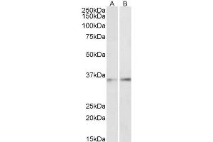 Image no. 1 for anti-CCAAT/enhancer Binding Protein (C/EBP), beta (CEBPB) (AA 68-81) antibody (ABIN5883747) (CEBPB 抗体  (AA 68-81))
