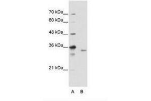 Image no. 2 for anti-Exosome Component 3 (EXOSC3) (C-Term) antibody (ABIN202145) (EXOSC3 抗体  (C-Term))