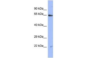 Host:  Rabbit  Target Name:  ZNF284  Sample Type:  HT1080 Whole cell lysates  Antibody Dilution:  1. (ZNF284 抗体  (N-Term))