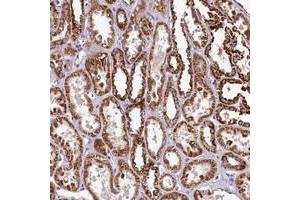 Immunohistochemical staining of human kidney with COQ9 polyclonal antibody  shows strong cytoplasmic positivity in renal tubules. (COQ9 抗体)