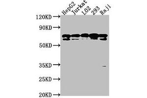 Western Blot Positive WB detected in: HepG2 whole cell lysate, Jurkat whole cell lysate, L02 whole cell lysate, 293 whole cell lysate, Raji whole cell lysate All lanes: HSPA1L antibody at 1:2000 Secondary Goat polyclonal to rabbit IgG at 1/50000 dilution Predicted band size: 71 kDa Observed band size: 71 kDa