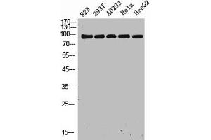 Western Blot analysis of 823 293T AD293 Hela HepG2 cells using NOXIN Polyclonal Antibody (C11orf82 抗体  (Internal Region))