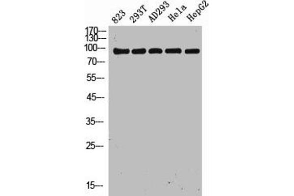 C11orf82 antibody  (Internal Region)