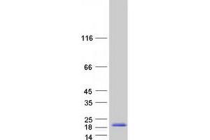Regenerating Islet-Derived 1 alpha (REG1A) protein (Myc-DYKDDDDK Tag)
