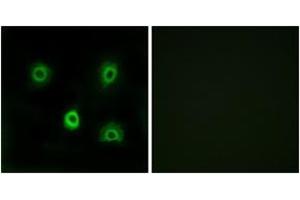 Immunofluorescence analysis of A549 cells, using ABHD6 Antibody. (ABHD6 抗体  (AA 231-280))