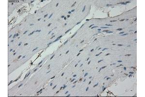 Immunohistochemical staining of paraffin-embedded colon tissue using anti-RPA2 mouse monoclonal antibody. (RPA2 抗体)