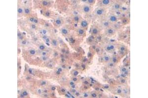 Used in DAB staining on fromalin fixed paraffin- embedded Kidney tissue (CDO1 抗体  (AA 1-200))