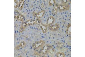 Immunohistochemistry of paraffin-embedded rat kidney using ARF1 antibody. (ARF1 抗体)
