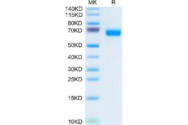 LCAT Protein (AA 25-440) (His tag)