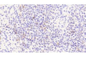 Immunohistochemistry (IHC) image for anti-Protein Kinase, AMP-Activated, beta 1 Non-Catalytic Subunit (PRKAB1) (AA 13-242) antibody (ABIN7433912)