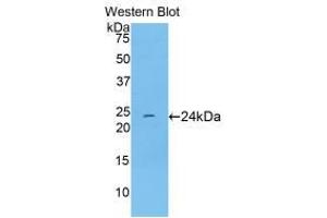 Western blot analysis of recombinant Rat TNNI1. (TNNI1 抗体  (AA 1-187))