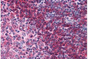 Human Tonsil: Formalin-Fixed, Paraffin-Embedded (FFPE) (BTK 抗体  (AA 91-387))