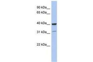 Image no. 1 for anti-Thrombopoietin (THPO) (C-Term) antibody (ABIN6744310) (Thrombopoietin 抗体  (C-Term))