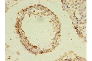 Immunohistochemistry of paraffin-embedded human testis tissue using ABIN7174767 at dilution of 1:100 (C19orf47 抗体  (AA 1-281))
