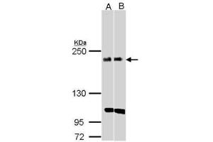WB Image Sample(30 ug whole cell lysate) A:H1299 B:Raji , 5% SDS PAGE antibody diluted at 1:1000 (KIDINS220 抗体  (C-Term))