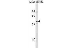 Western Blotting (WB) image for anti-Na+/K+ Transporting ATPase Interacting 2 (NKAIN2) antibody (ABIN2998903) (NKAIN2 抗体)