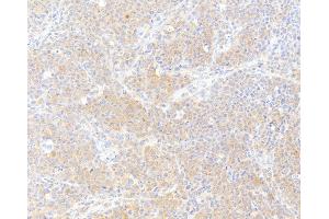 Immunohistochemistry (IHC) image for anti-Fatty Acid Synthase (FASN) (AA 2462-2511) antibody (ABIN7453707) (Fatty Acid Synthase 抗体  (AA 2462-2511))