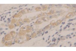 Immunohistochemistry (IHC) image for anti-Peroxiredoxin 2 (PRDX2) (AA 6-164) antibody (ABIN7436132)