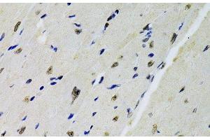 Immunohistochemistry of paraffin-embedded Mouse heart using DOK1 Polyclonal Antibody at dilution of 1:100 (40x lens). (DOK1 抗体)