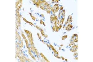 Immunohistochemistry of paraffin-embedded mouse heart using COL9A3 antibody at dilution of 1:100 (40x lens). (COL9A3 抗体)