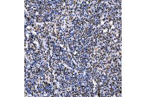 IHC analysis of SAE1 using anti-SAE1 antibody (ABIN7601346).