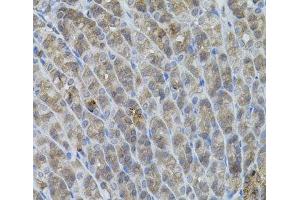 Immunohistochemistry of paraffin-embedded Mouse stomach using UBE2A Polyclonal Antibody (UBE2A 抗体)