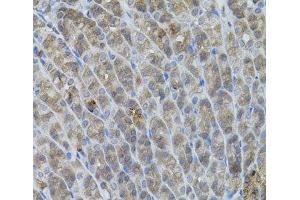 Immunohistochemistry of paraffin-embedded Mouse stomach using UBE2A Polyclonal Antibody (UBE2A 抗体)