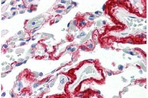 Human Lung (formalin-fixed, paraffin-embedded) stained with TIMP3 antibody ABIN337298 at 10 ug/ml followed by biotinylated anti-mouse IgG secondary antibody ABIN481714, alkaline phosphatase-streptavidin and chromogen. (TIMP3 抗体  (AA 170-188))