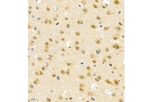 Immunohistochemistry of paraffin embedded mouse brain using PGBD5 (ABIN7075082) at dilution of 1:2000 (400x lens) (PGBD5 抗体)