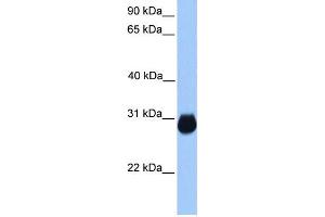 WB Suggested Anti-IGFBP7 Antibody Titration:  0. (IGFBP7 抗体  (C-Term))