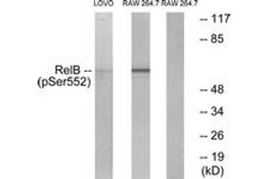 Western blot analysis of extracts from LOVO cells and RAW264. (RELB 抗体  (pSer573))